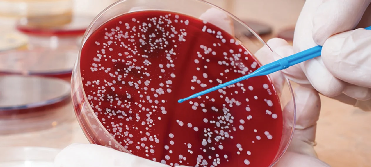 10 Unknown warning signs and symptoms of Blood Cancer